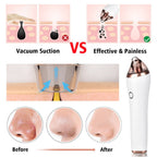 Exclusive 4 in 1 Body Guasha Cupping Blackhead Remover — Black — Alternate View 13