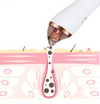 Exclusive 4 in 1 Body Guasha Cupping Blackhead Remover — Black — Top View