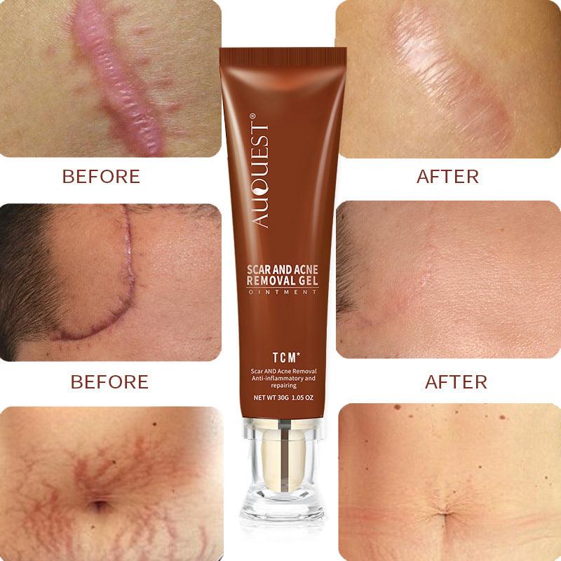 Exclusive Moisturizing And Repairing Scar Skin Care Cream — 30g — Alternate View 7
