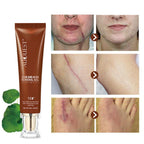 Exclusive Moisturizing And Repairing Scar Skin Care Cream — 30g — Top View