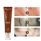 Exclusive Moisturizing And Repairing Scar Skin Care Cream — 30g — Detail View