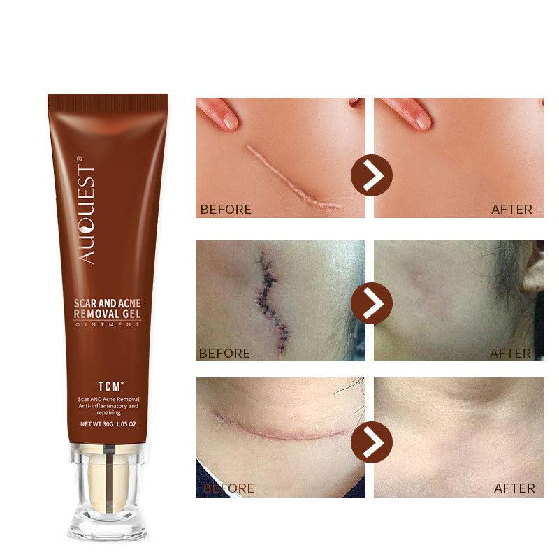 Exclusive Moisturizing And Repairing Scar Skin Care Cream — 30g — Detail View