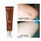 Exclusive Moisturizing And Repairing Scar Skin Care Cream — 30g — Side View
